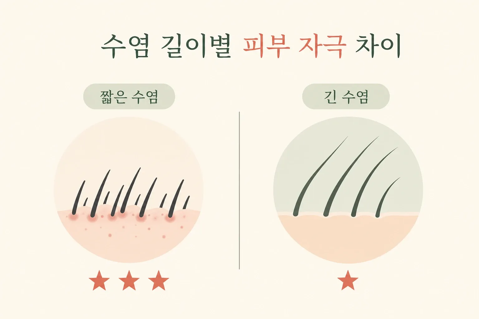 짧은 수염과 긴 수염 피부 자극 비교 인포그래픽